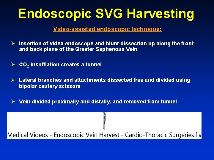Endoscopic SVG Harvesting Video-assisted endoscopic technique: Ø Insertion of video endoscope and blunt dissection
