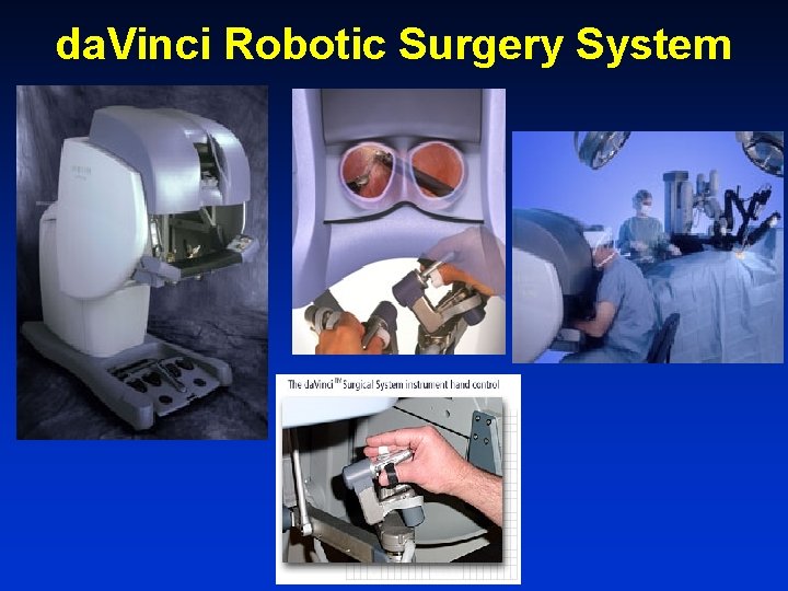 da. Vinci Robotic Surgery System 