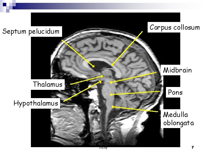 Corpus collosum Septum pelucidum Midbrain Thalamus Pons Hypothalamus Medulla oblongata Department of Biochemistry, SJC,