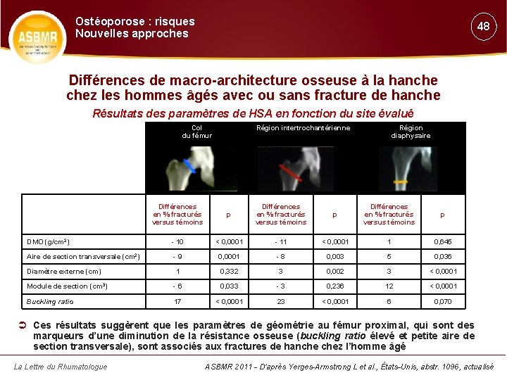 Ostéoporose : risques Nouvelles approches 48 Différences de macro-architecture osseuse à la hanche chez