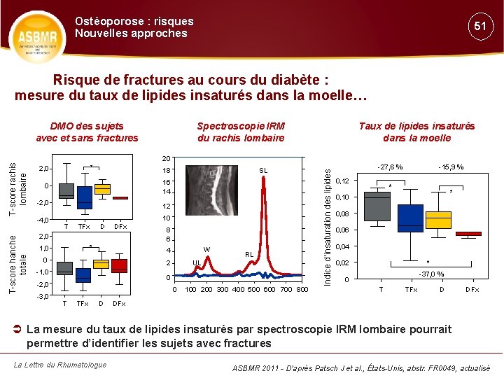 Ostéoporose : risques Nouvelles approches 51 Risque de fractures au cours du diabète :