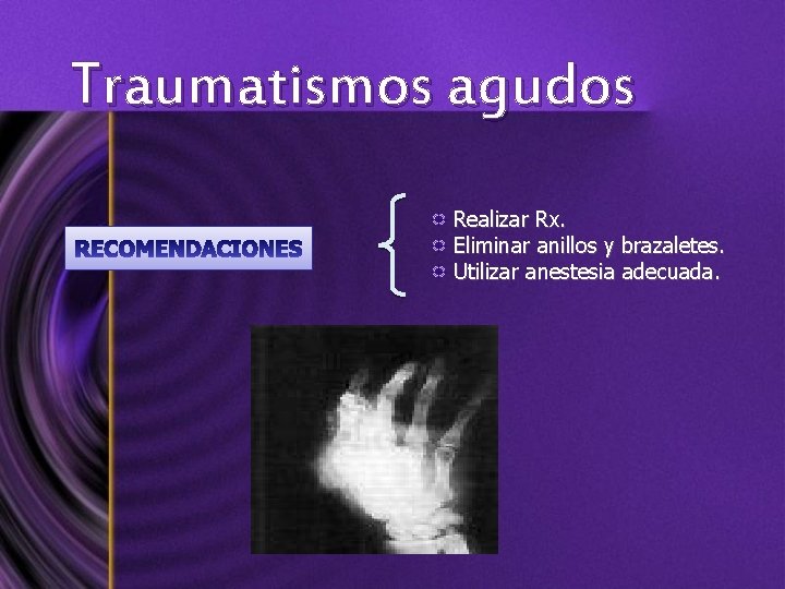 Traumatismos agudos Realizar Rx. Eliminar anillos y brazaletes. Utilizar anestesia adecuada. 