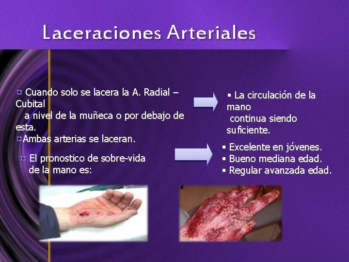Laceraciones Arteriales Cuando solo se lacera la A. Radial – Cubital a nivel de