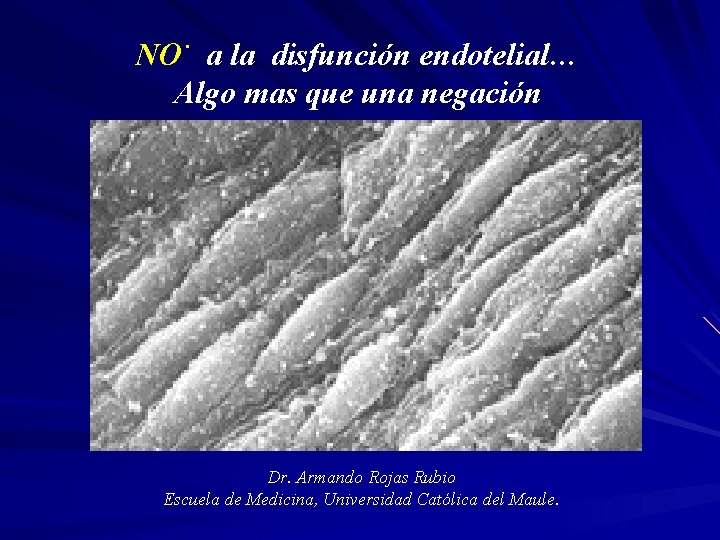 . NO a la disfunción endotelial… Algo mas que una negación Dr. Armando Rojas