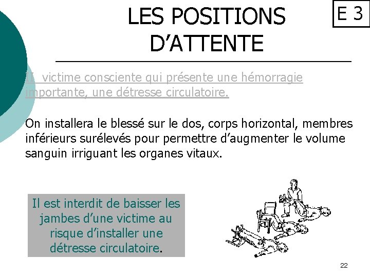LES POSITIONS D’ATTENTE E 3 II victime consciente qui présente une hémorragie importante, une