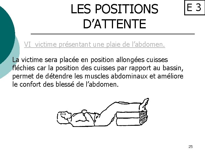 LES POSITIONS D’ATTENTE E 3 VI victime présentant une plaie de l’abdomen. La victime