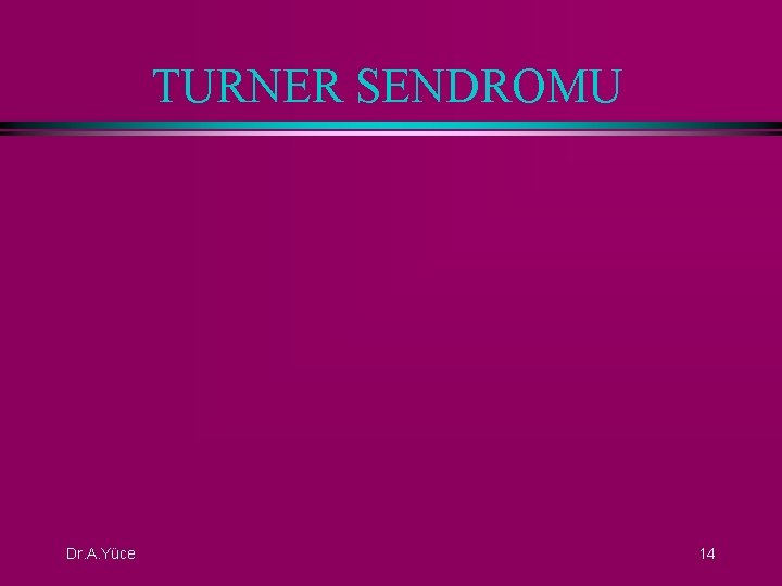 TURNER SENDROMU Dr. A. Yüce 14 