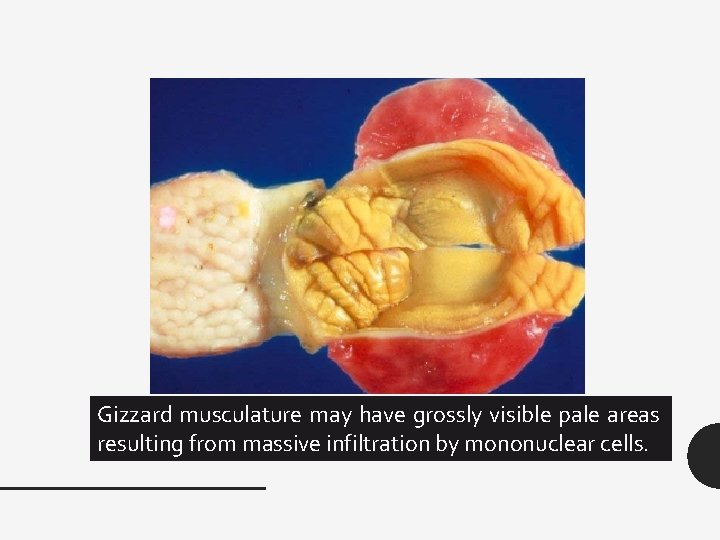 Gizzard musculature may have grossly visible pale areas resulting from massive infiltration by mononuclear