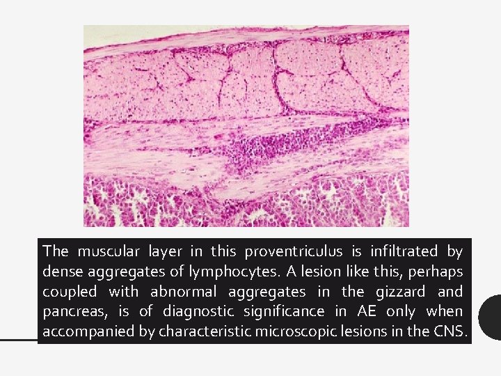 The muscular layer in this proventriculus is infiltrated by dense aggregates of lymphocytes. A