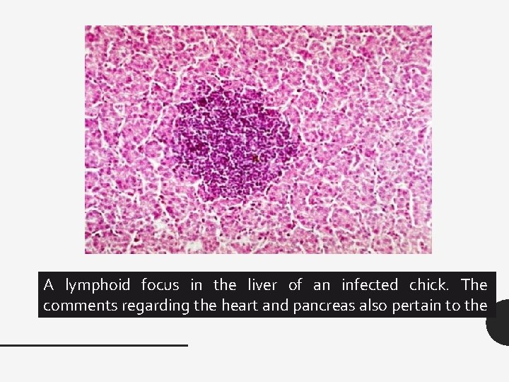 A lymphoid focus in the liver of an infected chick. The comments regarding the