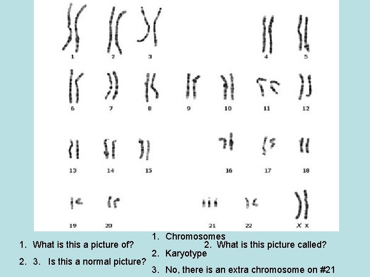 1. What is this a picture of? 2. 3. Is this a normal picture? 1. What is this a picture of? 2. 3. Is this a normal picture?