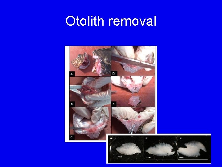 Otolith removal 