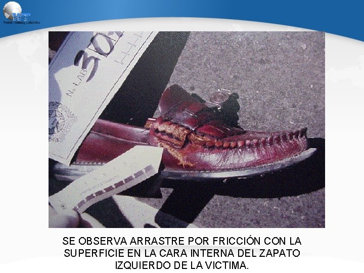 SE OBSERVA ARRASTRE POR FRICCIÓN CON LA SUPERFICIE EN LA CARA INTERNA DEL ZAPATO