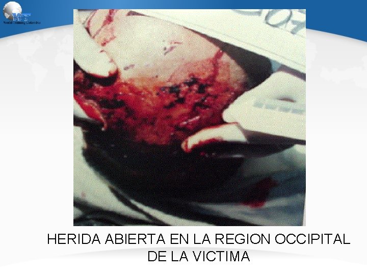 HERIDA ABIERTA EN LA REGION OCCIPITAL DE LA VICTIMA 