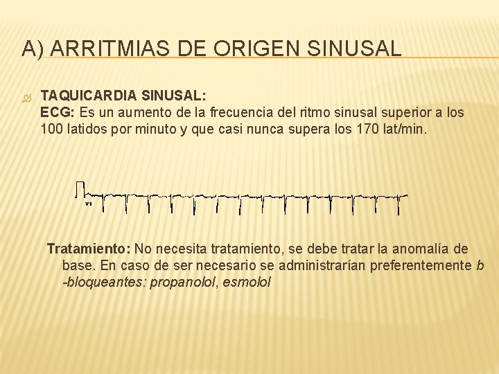 A) ARRITMIAS DE ORIGEN SINUSAL TAQUICARDIA SINUSAL: ECG: Es un aumento de la frecuencia