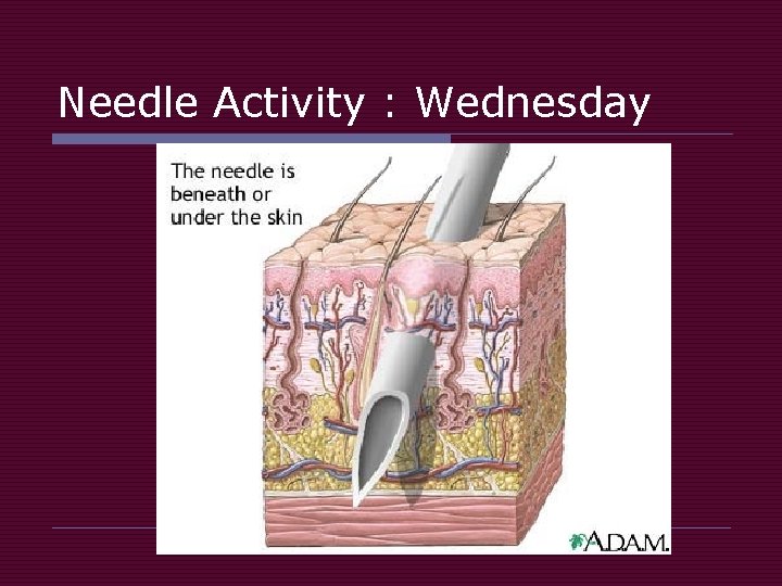 Needle Activity : Wednesday 