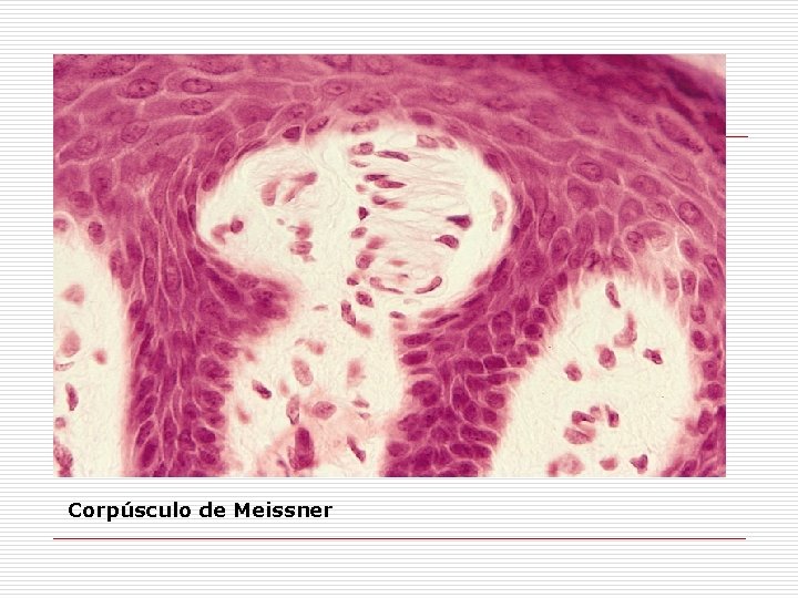 Corpúsculo de Meissner 