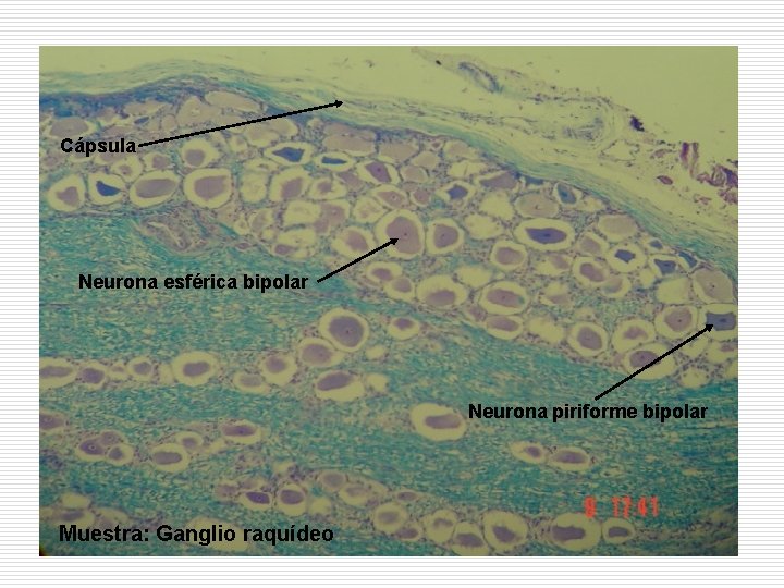 Cápsula Neurona esférica bipolar Neurona piriforme bipolar Muestra: Ganglio raquídeo 