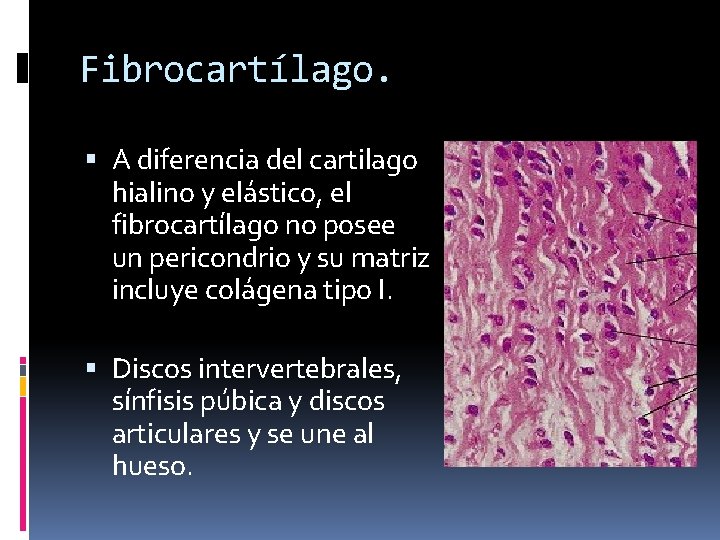 Fibrocartílago. A diferencia del cartilago hialino y elástico, el fibrocartílago no posee un pericondrio