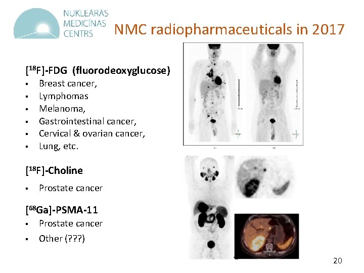 NMC radiopharmaceuticals in 2017 [18 F]-FDG (fluorodeoxyglucose) § § § Breast cancer, Lymphomas Melanoma,