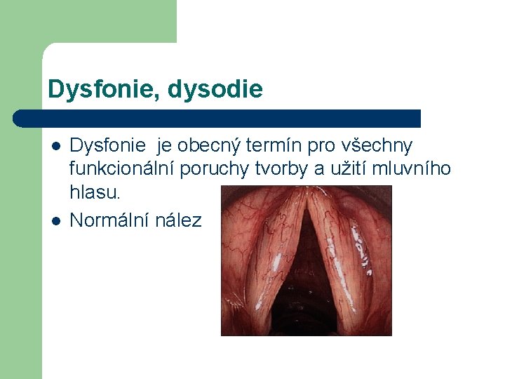 Dysfonie, dysodie l l Dysfonie je obecný termín pro všechny funkcionální poruchy tvorby a