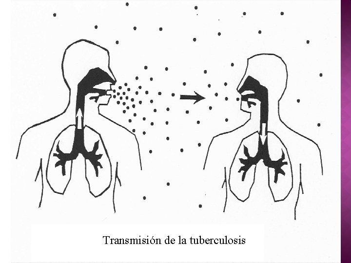 Transmisión de la tuberculosis 