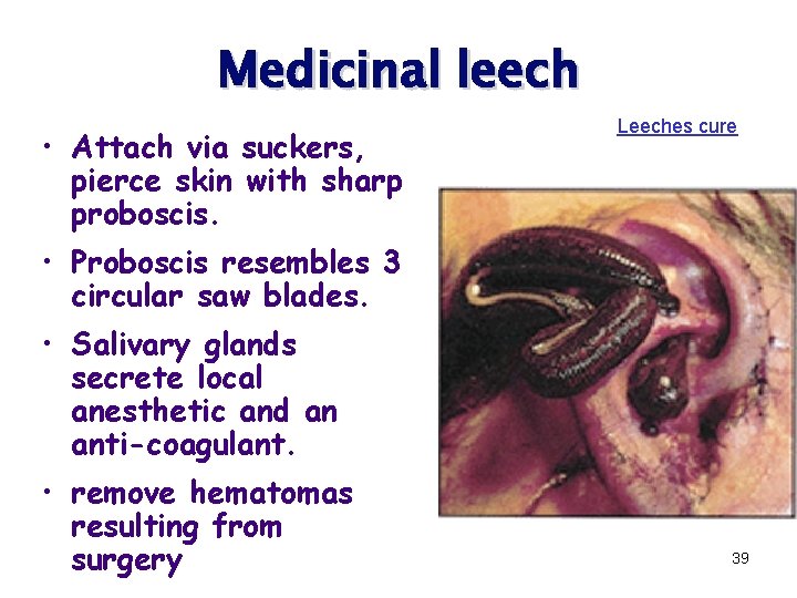 Medicinal leech • Attach via suckers, pierce skin with sharp proboscis. Leeches cure •