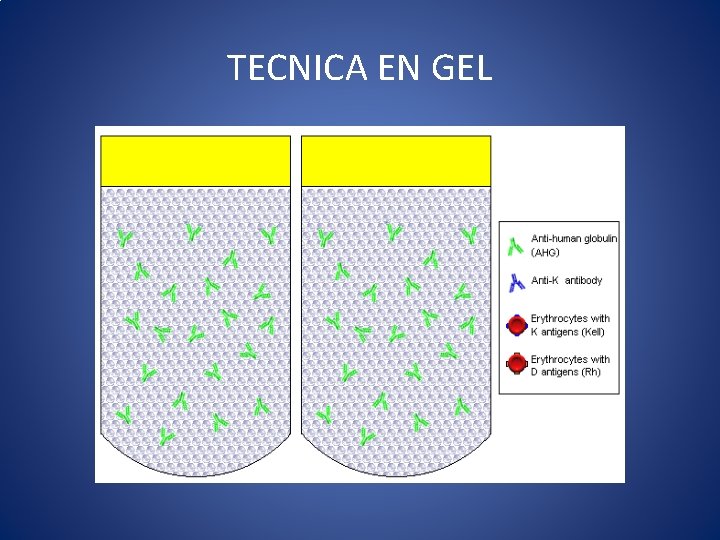 TECNICA EN GEL 