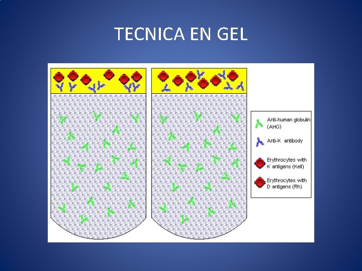 TECNICA EN GEL 