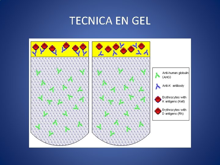 TECNICA EN GEL TECNICA EN GEL