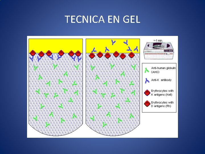 TECNICA EN GEL TECNICA EN GEL
