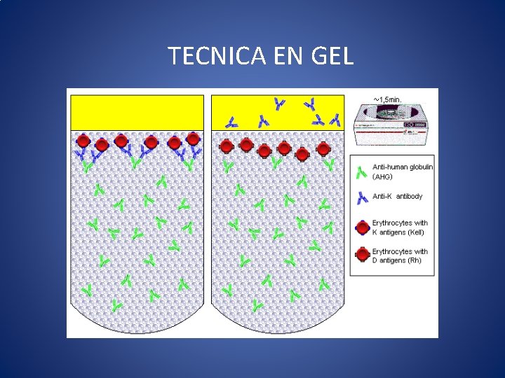 TECNICA EN GEL 