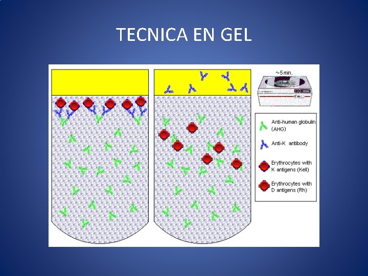 TECNICA EN GEL 