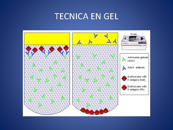 TECNICA EN GEL TECNICA EN GEL