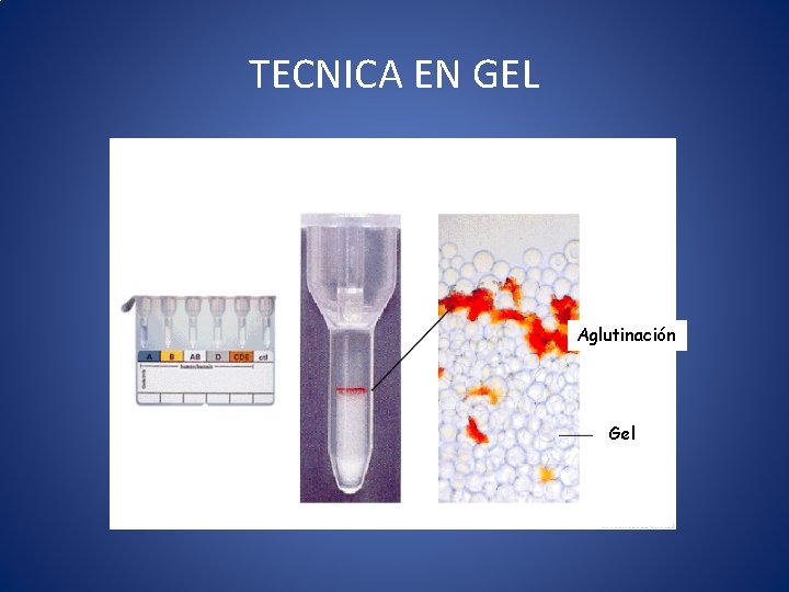 TECNICA EN GEL Aglutinación Gel 