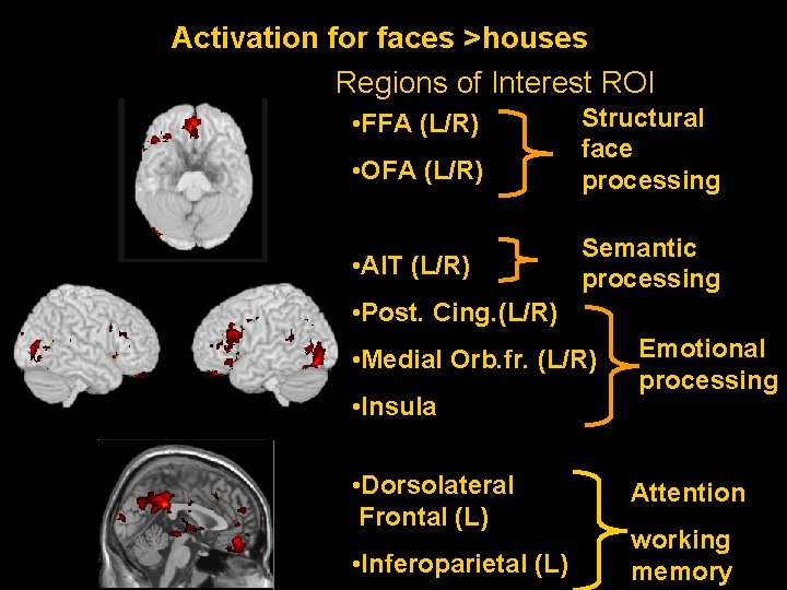 Activation for faces >houses Regions of Interest ROI • FFA (L/R) • OFA (L/R)