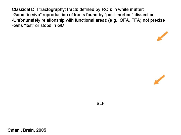 Classical DTI tractography: tracts defined by ROIs in white matter: -Good “in vivo” reproduction