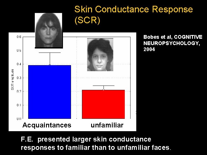 Skin Conductance Response (SCR) Bobes et al, COGNITIVE NEUROPSYCHOLOGY, 2004 Acquaintances unfamiliar F. E.