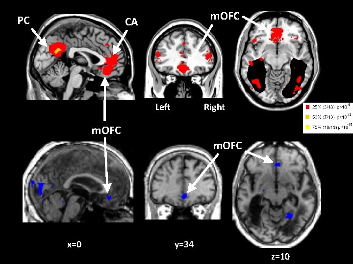 PC m. OFC CA Left Right m. OFC x=0 y=34 z=10 