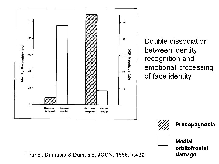 Double dissociation between identity recognition and emotional processing of face identity Prosopagnosia Tranel, Damasio