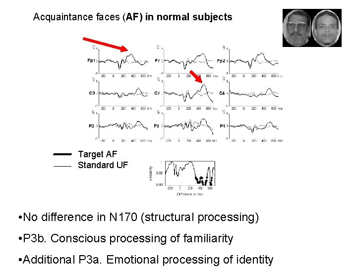 Acquaintance faces (AF) in normal subjects Target AF Standard UF • No difference in