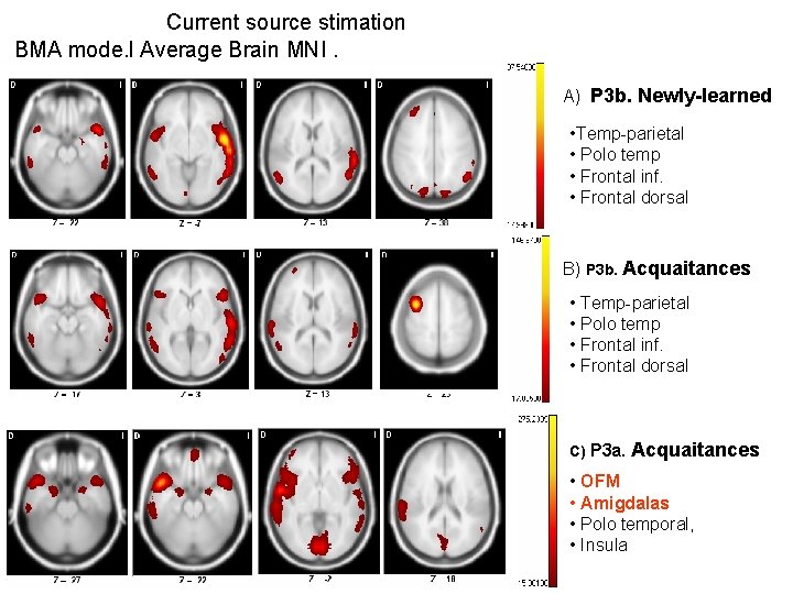 Current source stimation BMA mode. l Average Brain MNI. A) P 3 b. Newly-learned