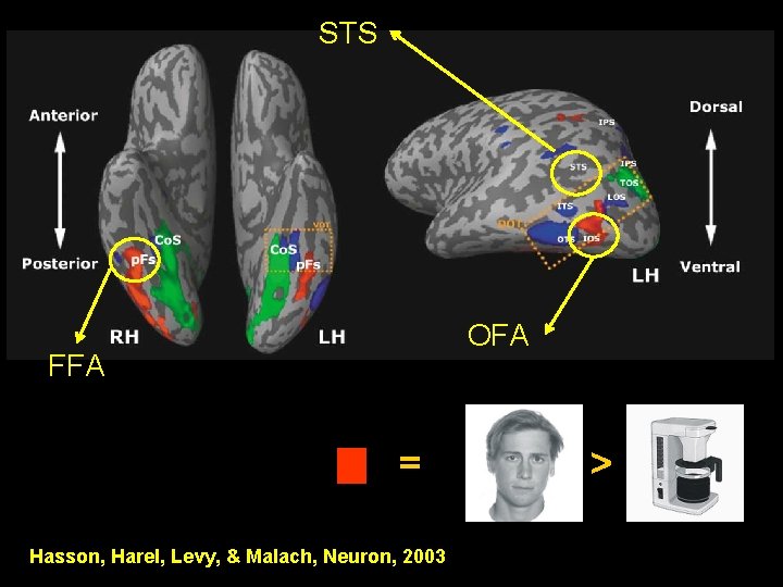 STS OFA FFA = Hasson, Harel, Levy, & Malach, Neuron, 2003 > 