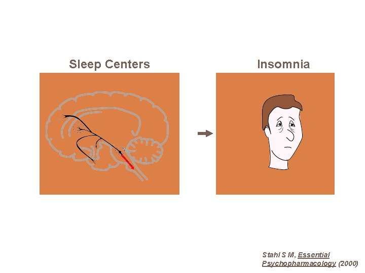 Sleep Centers Insomnia Stahl S M, Essential Psychopharmacology (2000) 