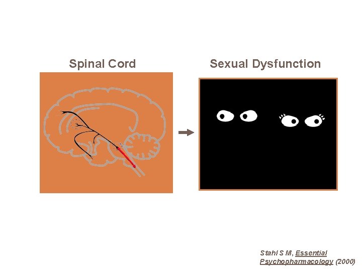 Spinal Cord Sexual Dysfunction Stahl S M, Essential Psychopharmacology (2000) 