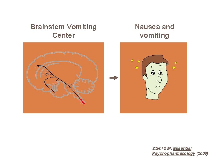 Brainstem Vomiting Center Nausea and vomiting Stahl S M, Essential Psychopharmacology (2000) 