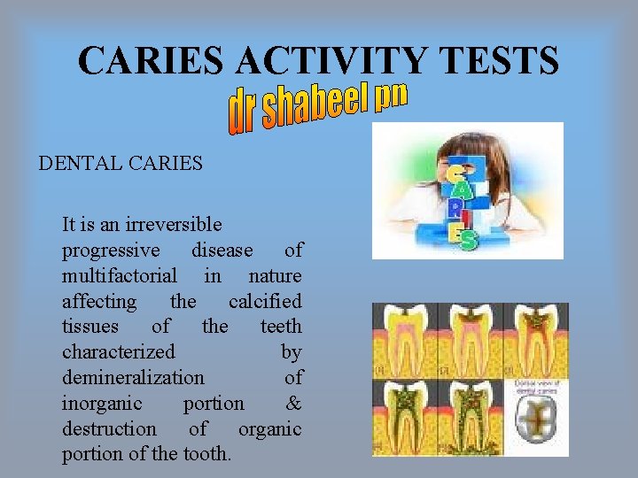 CARIES ACTIVITY TESTS DENTAL CARIES It is an irreversible progressive disease of multifactorial in