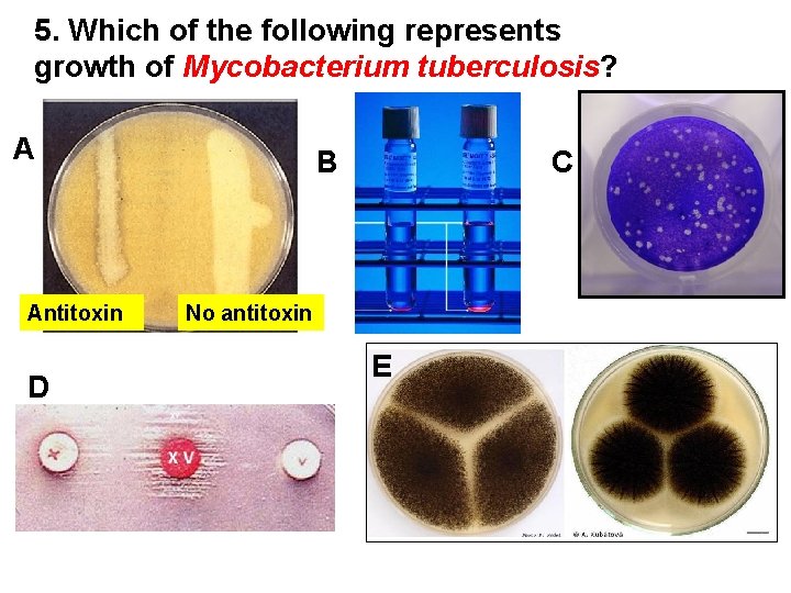 5. Which of the following represents growth of Mycobacterium tuberculosis? A Antitoxin D B