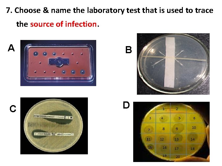 7. Choose & name the laboratory test that is used to trace the source