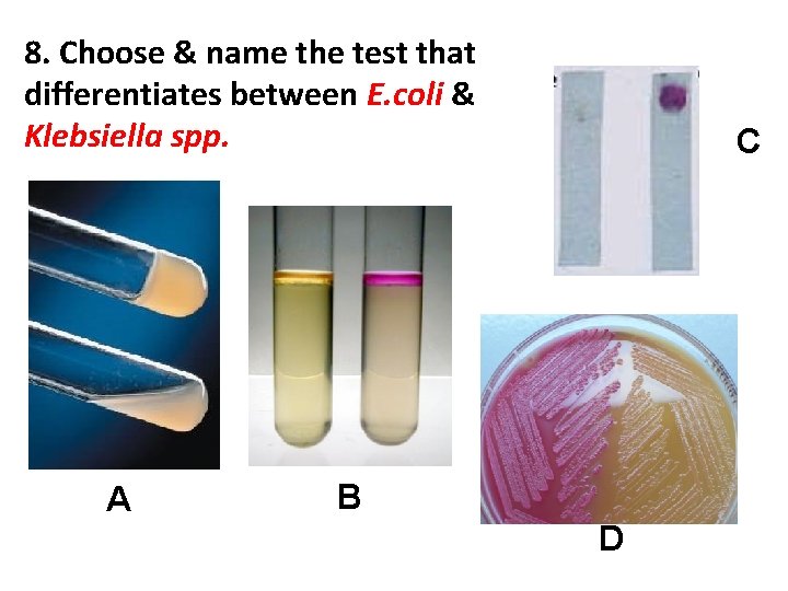 8. Choose & name the test that differentiates between E. coli & Klebsiella spp.